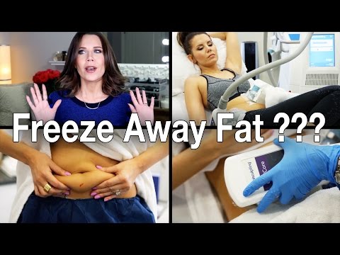 FREEZE AWAY FAT ??? | Does Coolsculpting Work?