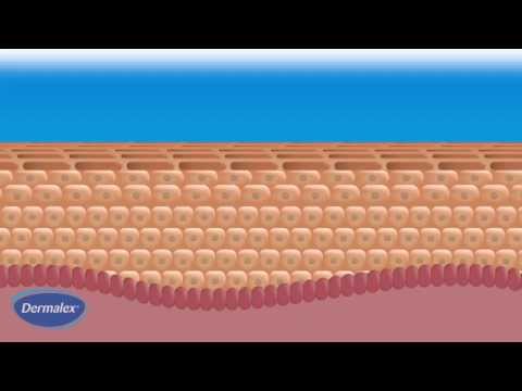 Dermalex Eczema - how it works
