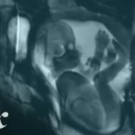 Life looks really different through an MRI machine – VOX